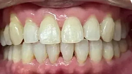 Smile after treatment