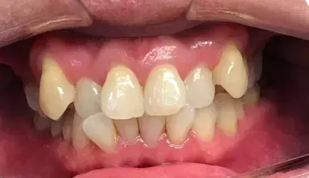 Smile before treatment